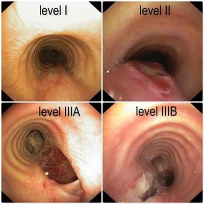 Post-intubation tracheal lacerations: Risk-stratification and treatment protocol according to morphological classification